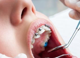 orthodontic assisting permit
